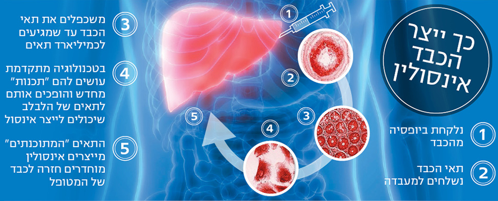 הפיתוח הישראלי שיגרום לתאי כבד לרפא סוכרת